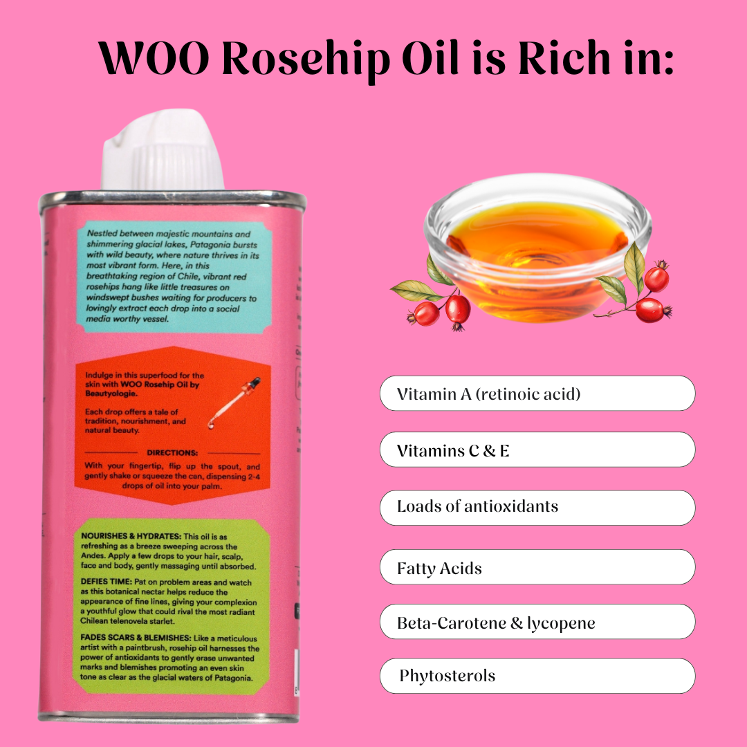 Rosehip Oil is rich in vitamins
